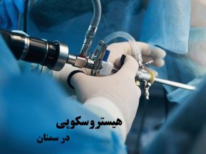 بهترین دکتر هیستروسکوپی در سمنان