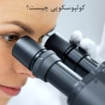 کولپوسکوپی یک روش تشخیص بیماری زنان و پیشگیری از سرطان دهانه رحم است