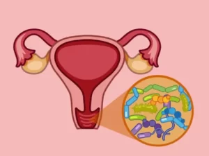 عفونت واژن در دختران