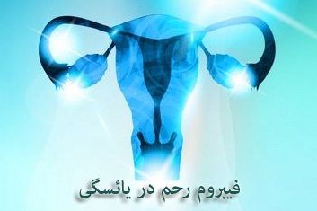 فیبروم رحم در یائسگی